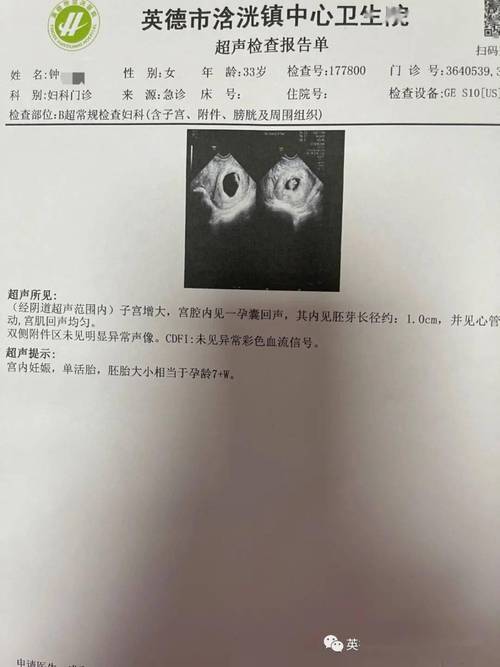 试管婴儿、生殖健康、白带异常检测