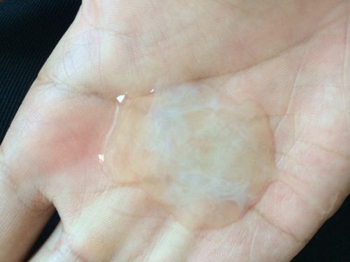精子质量差