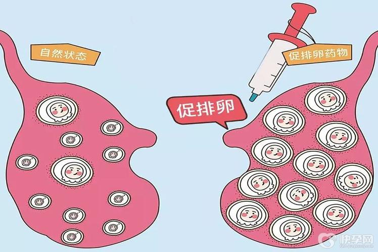 促排卵