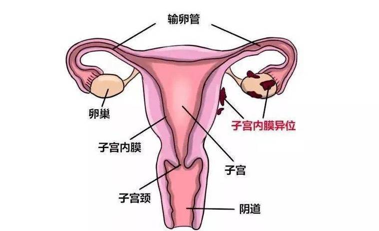 子宫情况