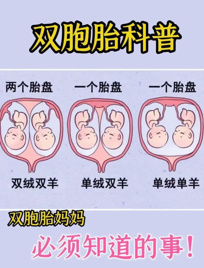 助孕双胞胎