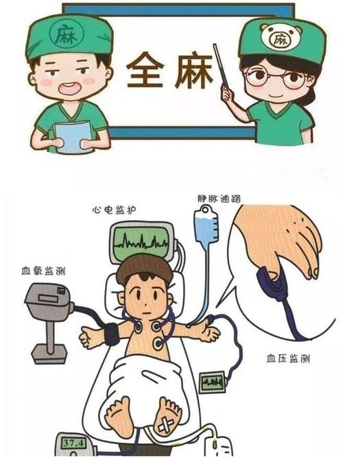 全身麻醉