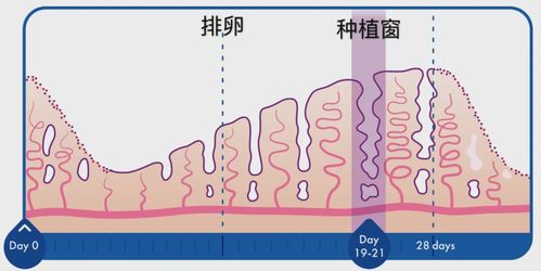 种植窗