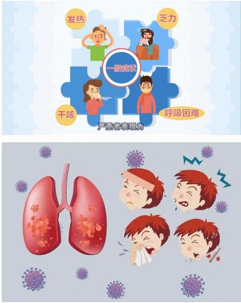 肺炎