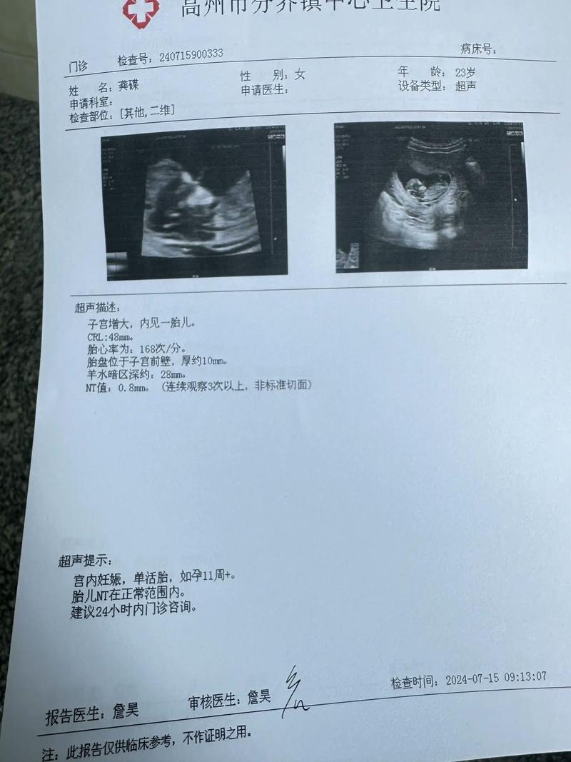 3 个半月孕程