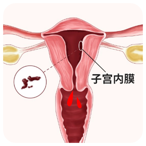  子宫内膜环境