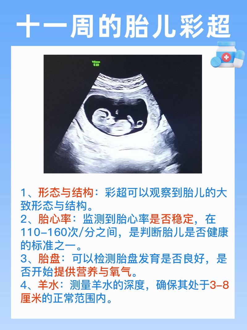十一周胎儿发育