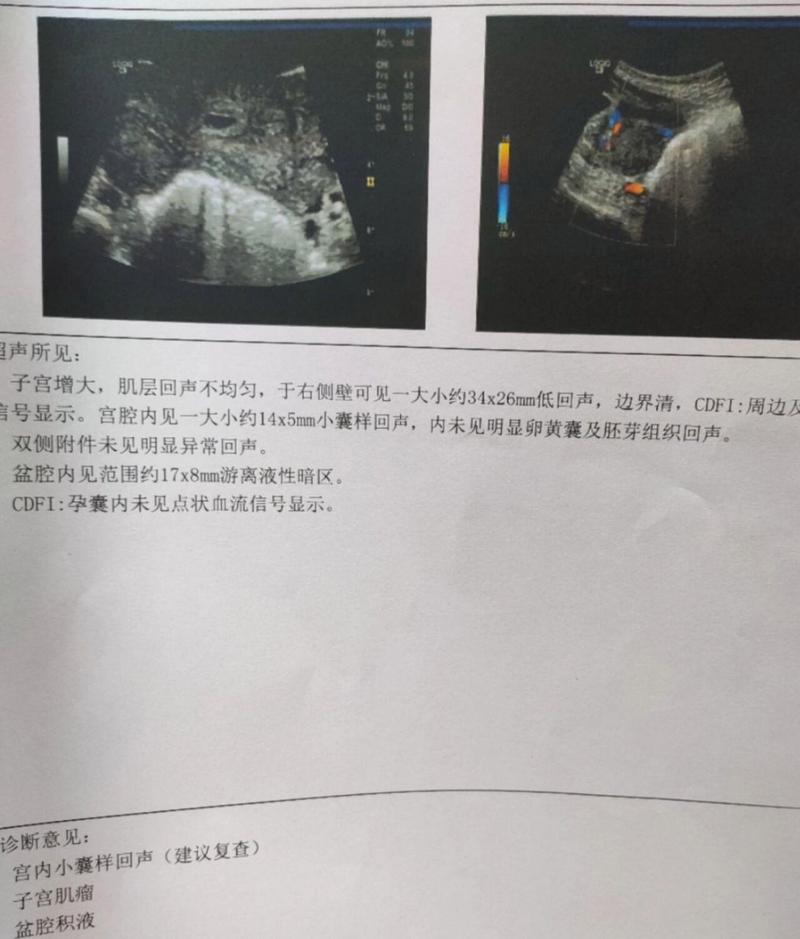 雌二醇低