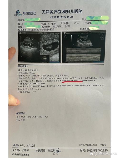 胚胎积液