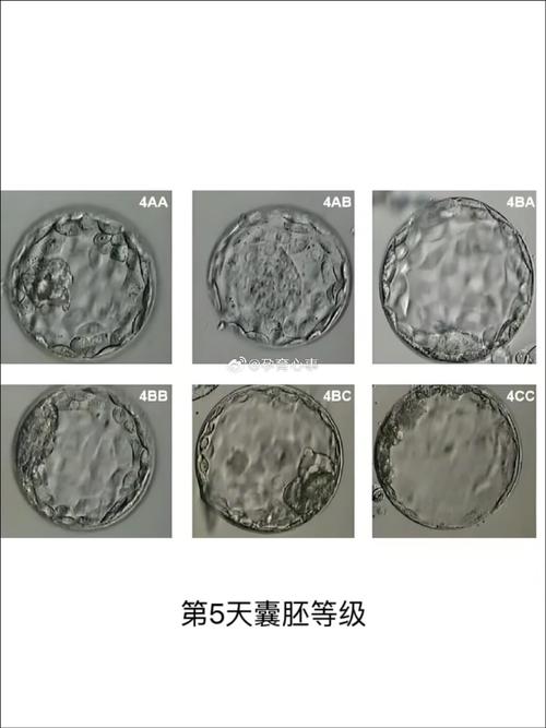 试管婴儿、胚胎质量、子宫内膜、心理状态