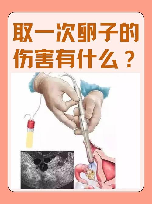 试管婴儿：从取卵到怀孕有多快？