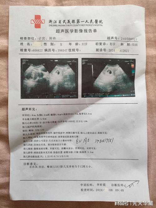阴道超声检查