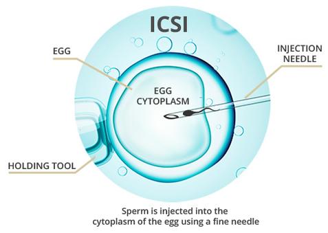 ICSI 技术