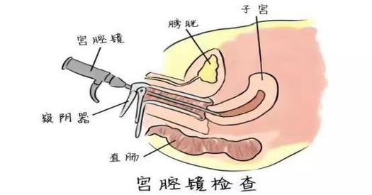  取胚胎