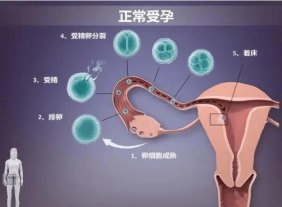 生殖医学
描述: 本文对比了试管婴儿与传统生育方式对孩子智力的影响，通过数据及案例说明二者在智力方面无明显差异，强调孩子智力受多种因素影响，呼吁用科学眼光看待生育方式。