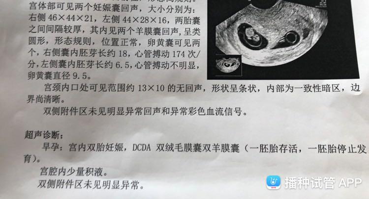 试管婴儿：解决胎停的有效方案？