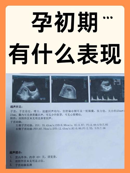 孕育经历