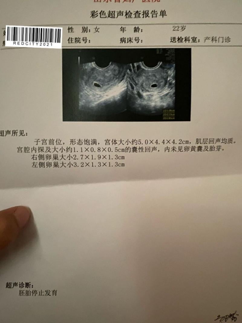 胚胎诊断