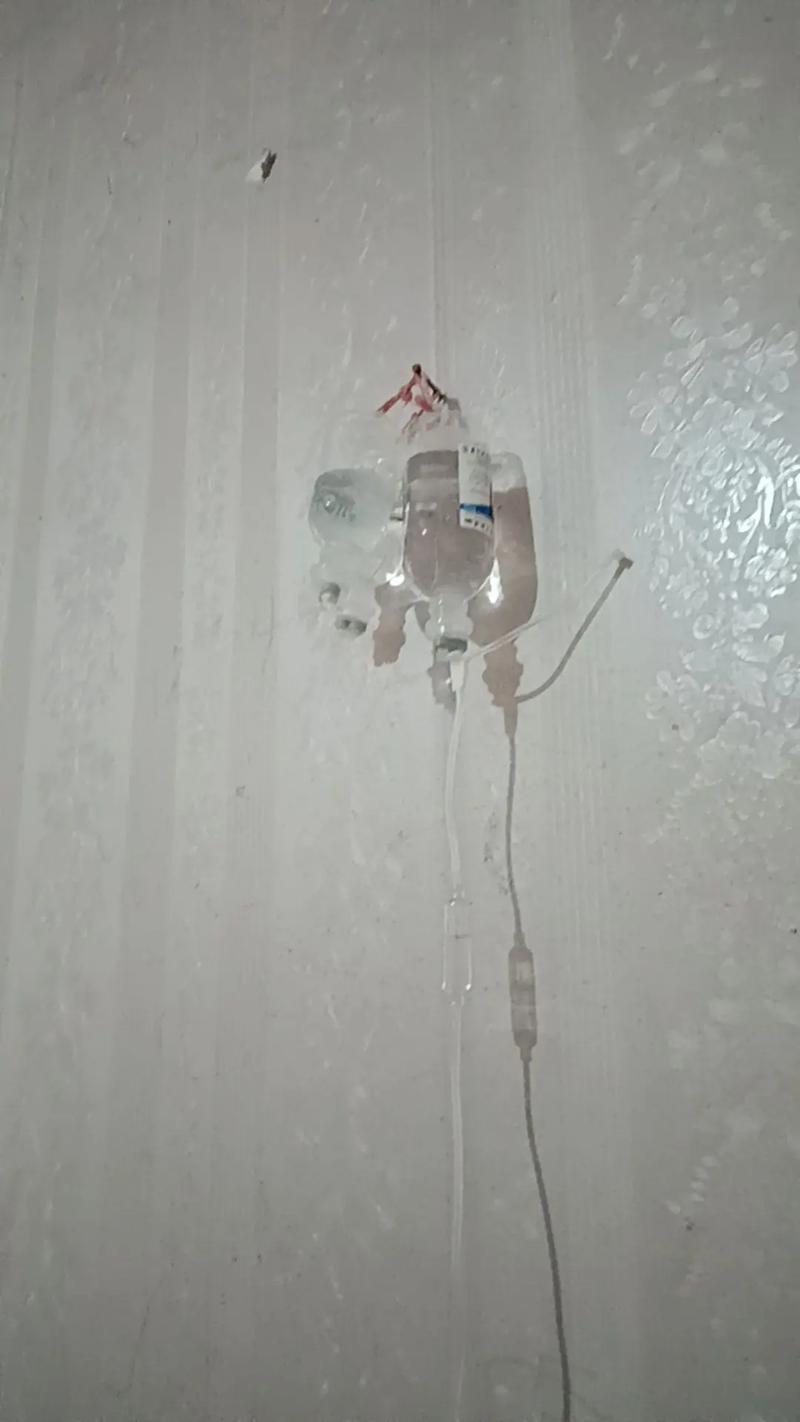 医疗建议
描述: 本文详细介绍了试管婴儿过程中打点滴消炎的相关知识，包括打点滴消炎的原因，以及打点滴前后及过程中的注意事项，并给出实用建议，助力试管婴儿顺利进行。