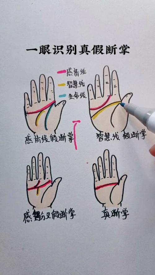 断掌