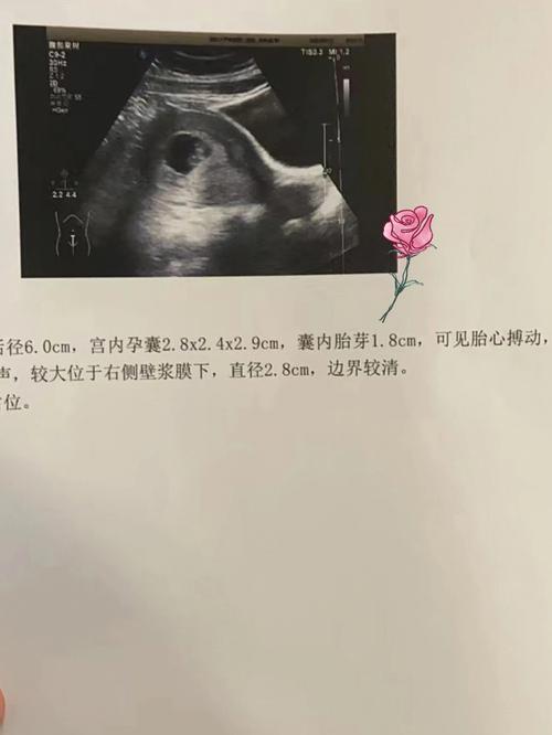 移植40天