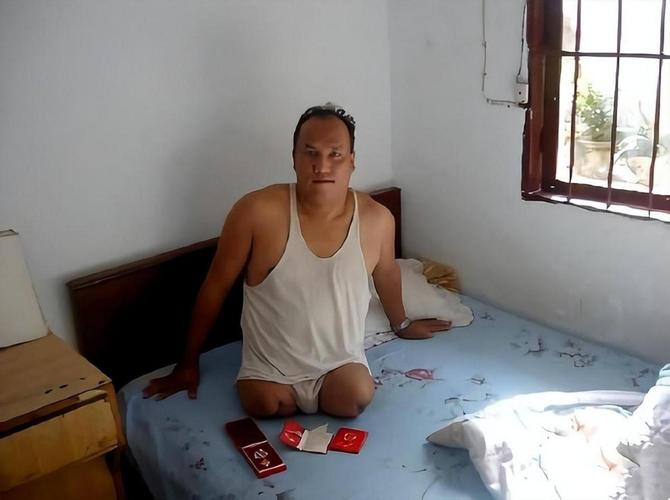残疾症状