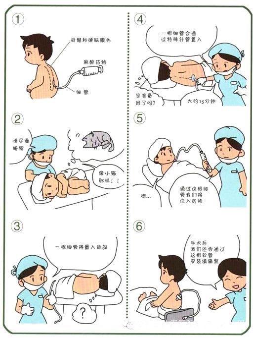  麻醉方式