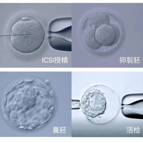 胚囊筛查技术