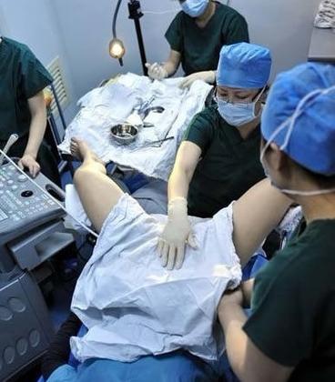 费县是否能进行试管婴儿手术？