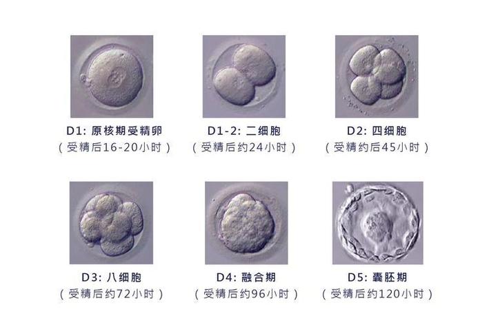 囊胚选择