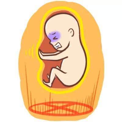 胎儿生长受限