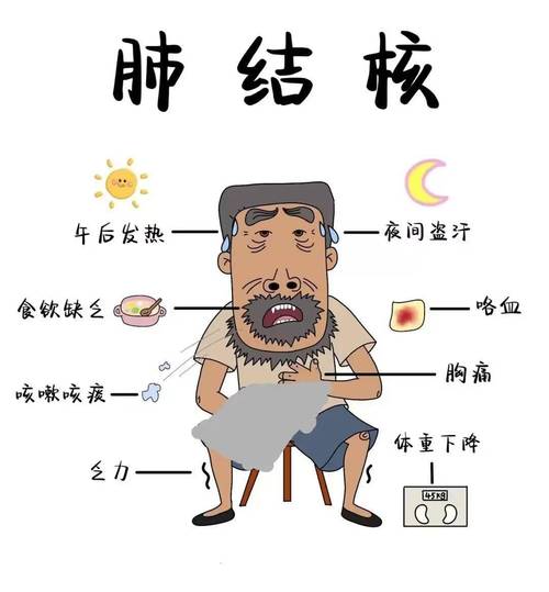  结核病