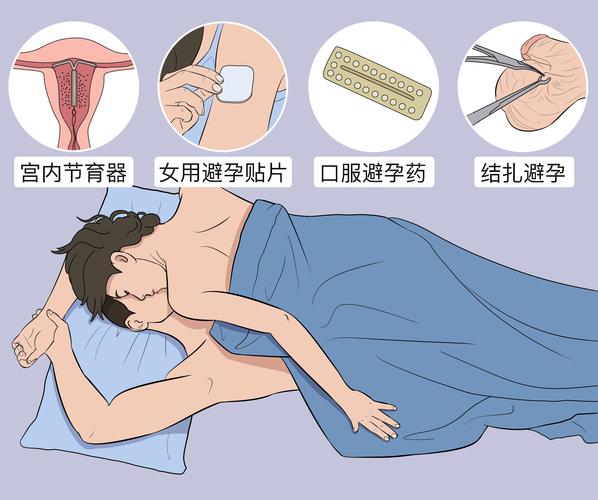 避孕