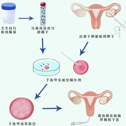 试管婴儿与自然孕育的生命价值是否等同？