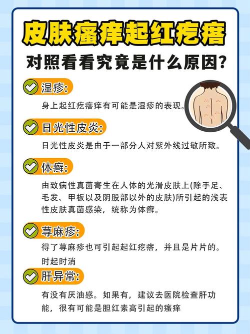  痒痒原因