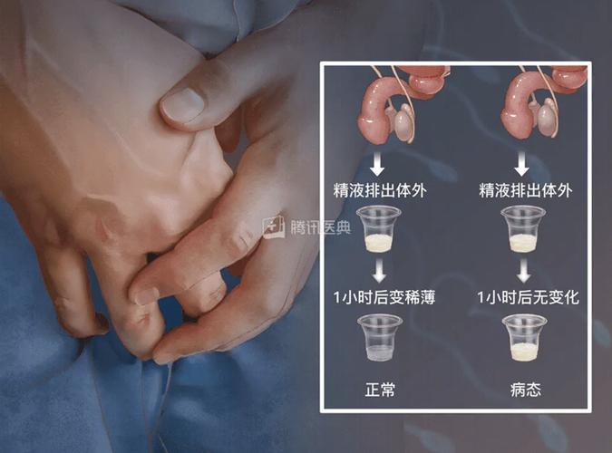 取精效率