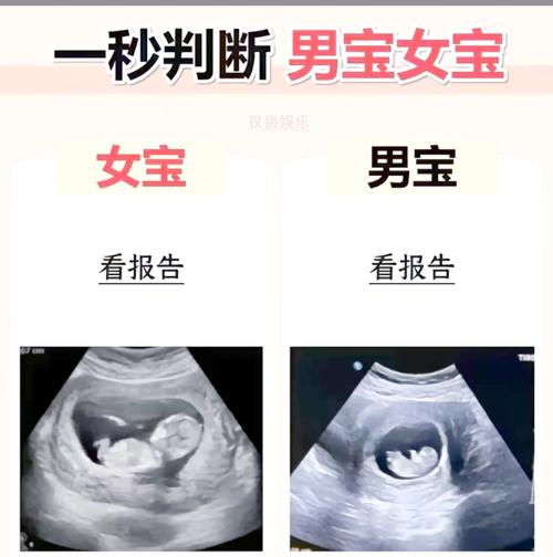 胎儿性别判断
