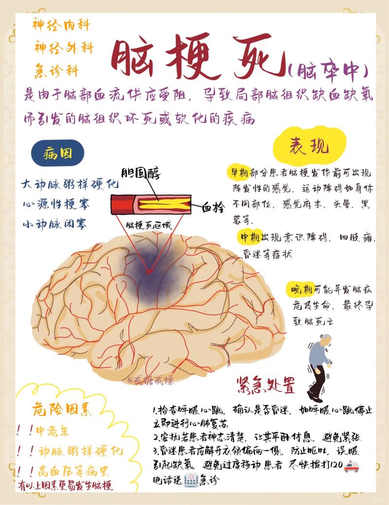 脑梗死