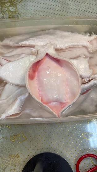 取内膜