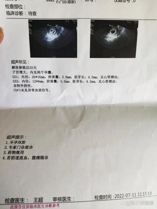 25天见红