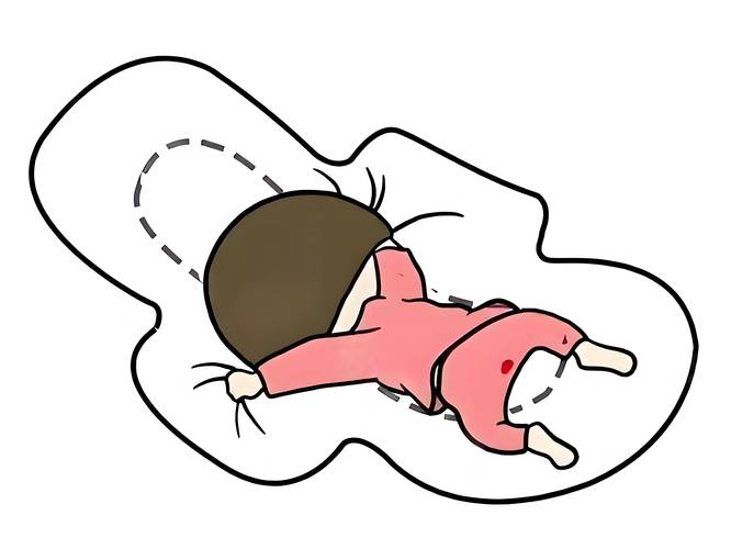 姨妈感消失