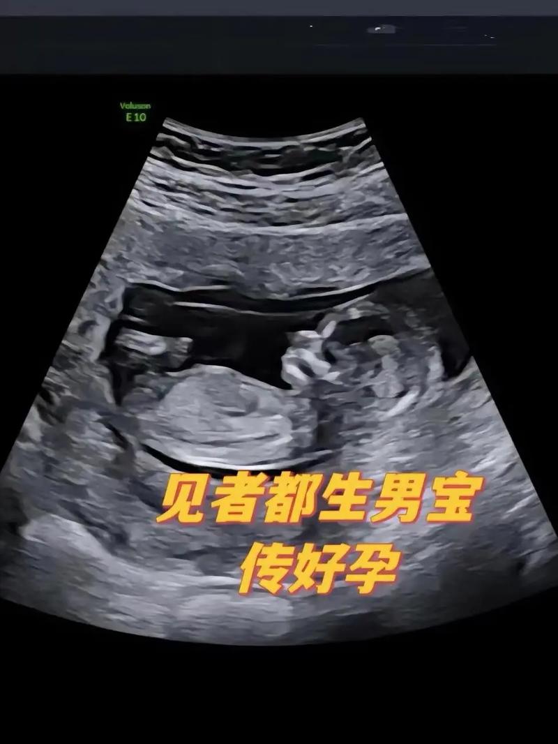 男孩胚胎