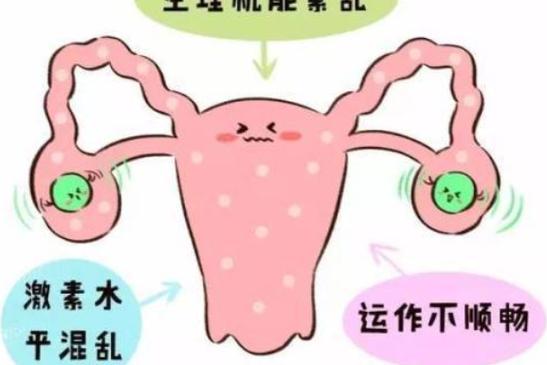 女性激素紊乱