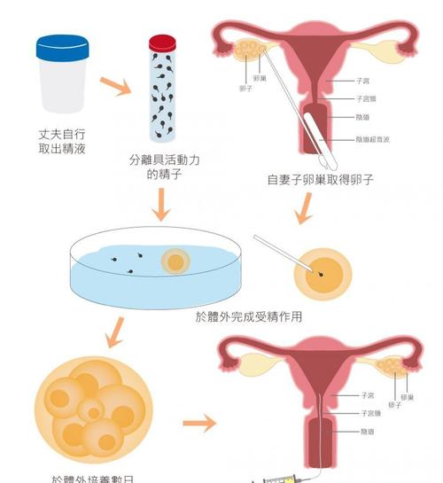 试管婴儿实验过程