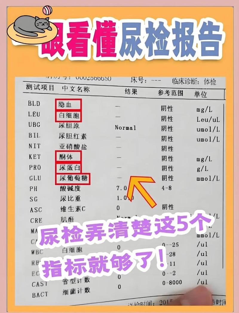  验尿检查