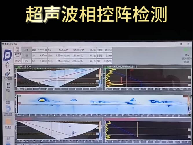 超声监测