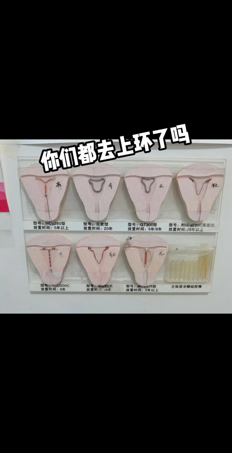 上环