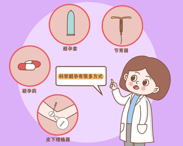 产后避孕