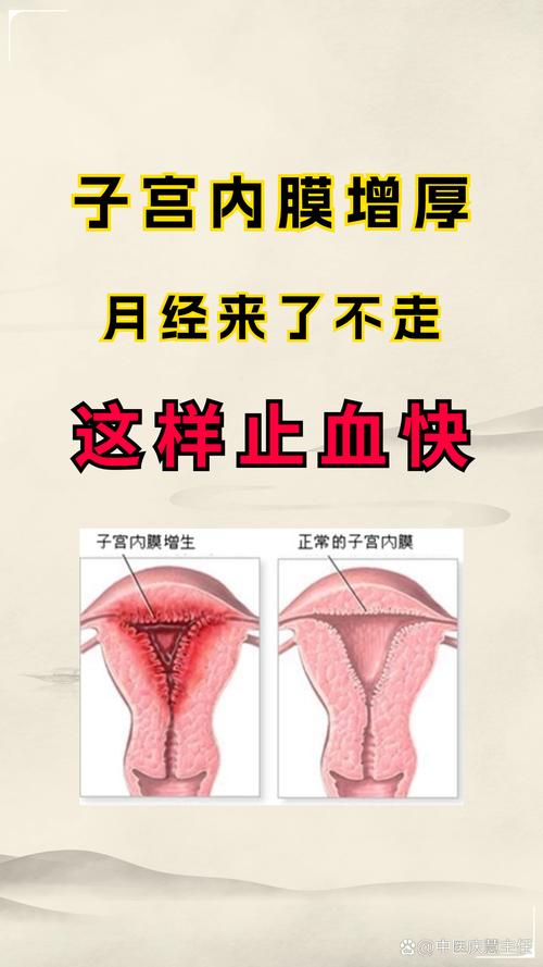 催内膜