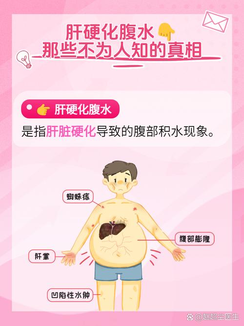 腹水现象